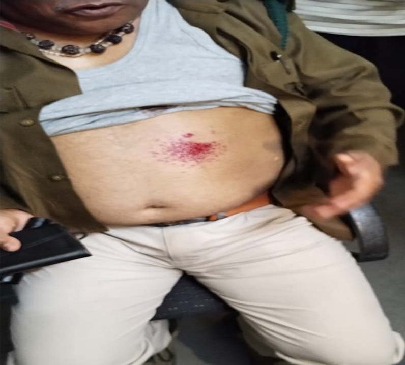 श्योपुर :वनपाल ने रेंजर को मारी गोली, हालत गंभीर
