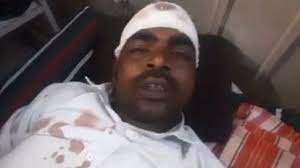  स्कूल की बाउंड्री का काम करा कर लौट रहे सरपंच पति पर हमला, हमलावर बोले- हम सिखाते हैं तुझे सरपंची