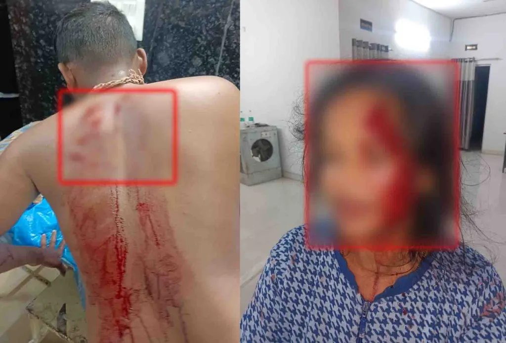 CG : पड़ोसियों के बीच हुई जमकर मारपीट, घायल मेकाहारा में भर्ती