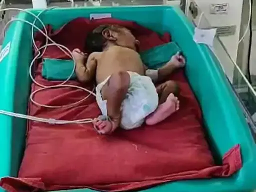CG : मेडिकल कॉलेज अस्पताल में नवजातों के लिए नई सुविधा