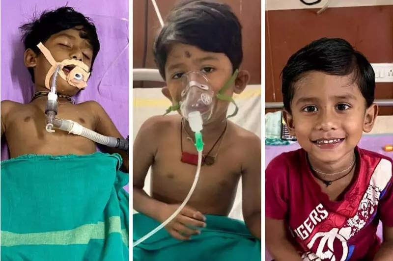 CG : करैत के डसने से मरणासन्न हो गया था मासूम, मेडिकल कॉलेज हॉस्पिटल में मिला नया जीवन