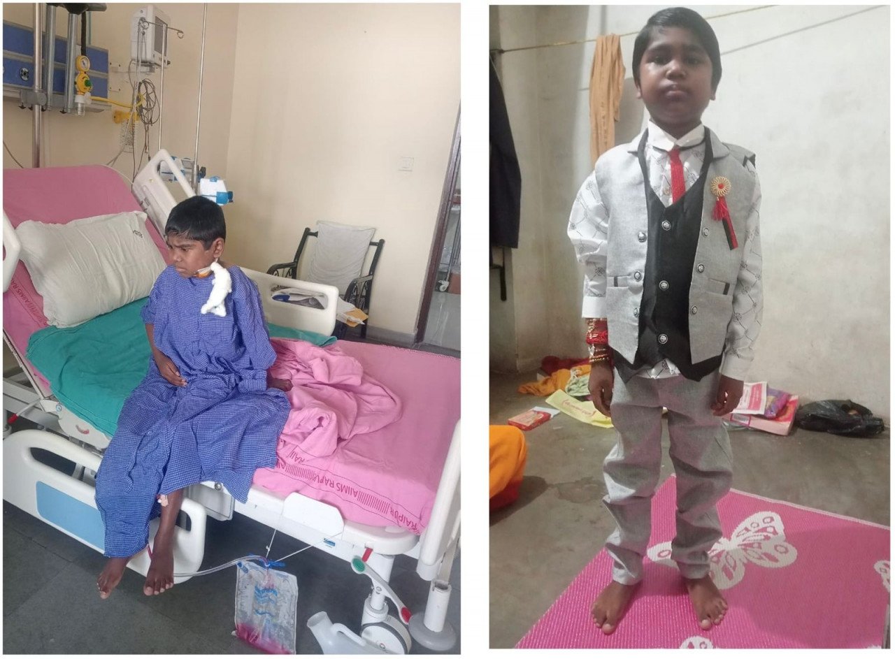 CG : मुख्यमंत्री विशेष स्वास्थ्य सहायता योजना : कृष्णा वर्मा के जीवन में मुख्यमंत्री विशेष स्वास्थ्य सहायता योजना का योगदान, चेहरे पर भी मुस्कान लौट आई