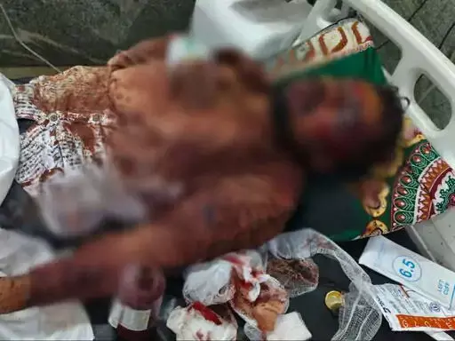 CG : साजिश के तहत बुलाया, चाकू मारे और मरा समझकर भागे दगाबाज दोस्त