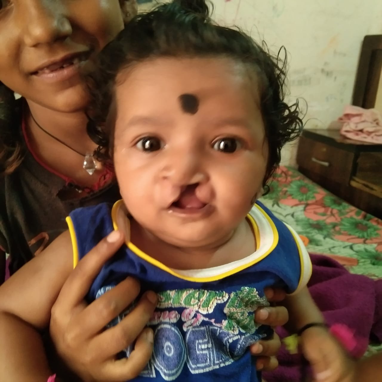 CG : चिरायु योजना ने लौटाई मासूमों की मुस्कान