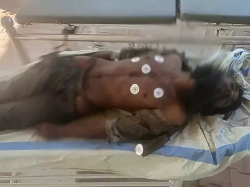 CG : भीख मांगकर गुजारा करने वाला युवक की ठंड लगने से मौत…