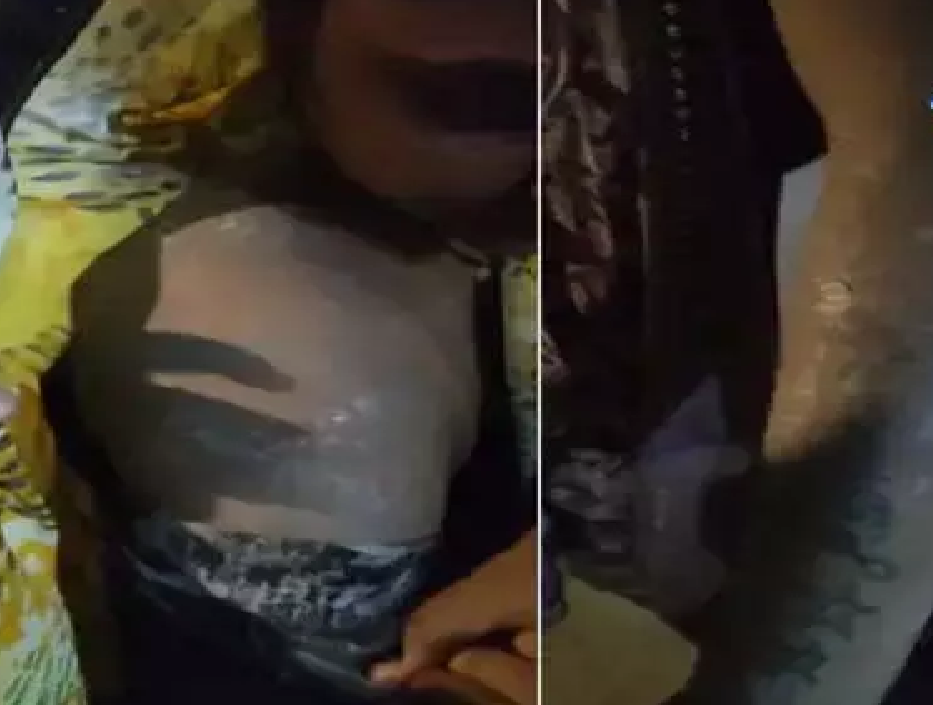 CG : किचन में लगी आग, गैस सिलेंडर का पाइप फटने से हुई बड़ी घटना, कई घायल …