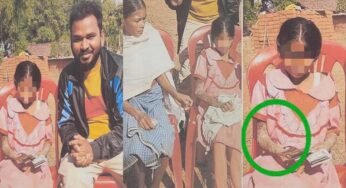 पत्थर शरीर वाली बच्ची के उपचार को लेकर बाल आयोग सक्रिय