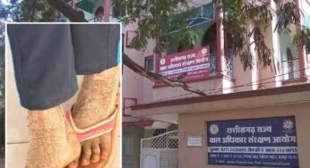 बाल आयोग अध्यक्ष की पहल रंग लाई, गंभीर बीमार बालिका का इलाज शुरू