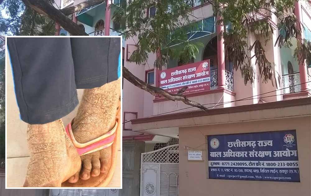 बाल आयोग अध्यक्ष की पहल रंग लाई, गंभीर बीमार बालिका का इलाज शुरू