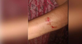 CG : घर में घुसकर महिला के साथ मारपीट, पुलिस जांच में जुटी …