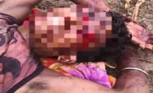 CG : भालू का हमला, युवक गंभीर रूप से घायल, जगदलपुर मेडिकल कॉलेज …