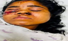 CG : रेल हादसे में घायल मुंगेली की युवती सिम्स में भर्ती, परिजनों की तलाश जारी