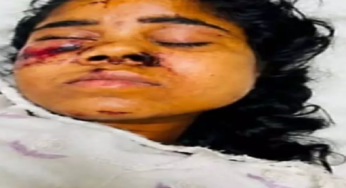 CG : रेल हादसे में घायल मुंगेली की युवती सिम्स में भर्ती, परिजनों की तलाश जारी