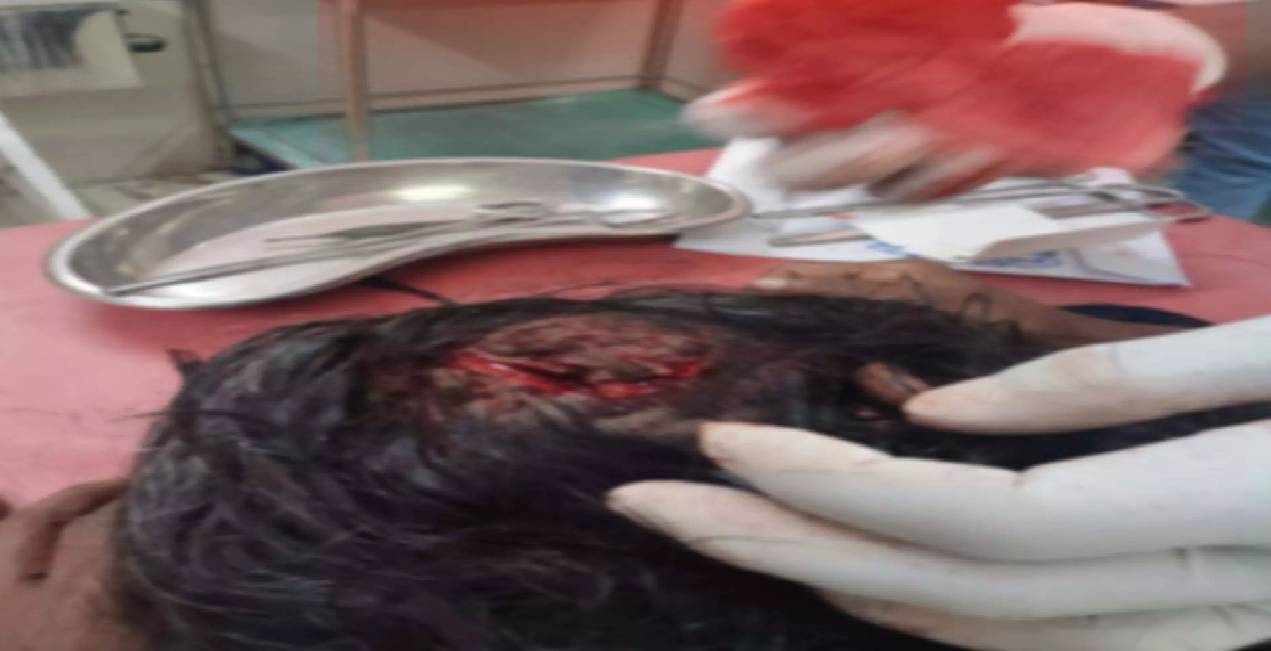 CG : रायगढ़ में बंदरों ने कई लोगों को काटा, हाथियों के झुंड ने किया सड़क जाम …