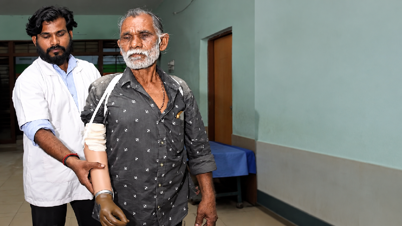 CG : ट्रेन हादसे के पीड़ित को ‘सेवा संकल्प’ से राहत, महज दो घंटे में मिला कृत्रिम हाथ…